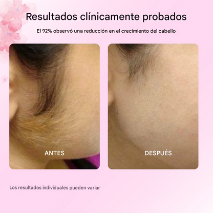 OFERTA ESPECIAL LLEVA DOS ACEITES DE CYPERUS ROTUNDUS