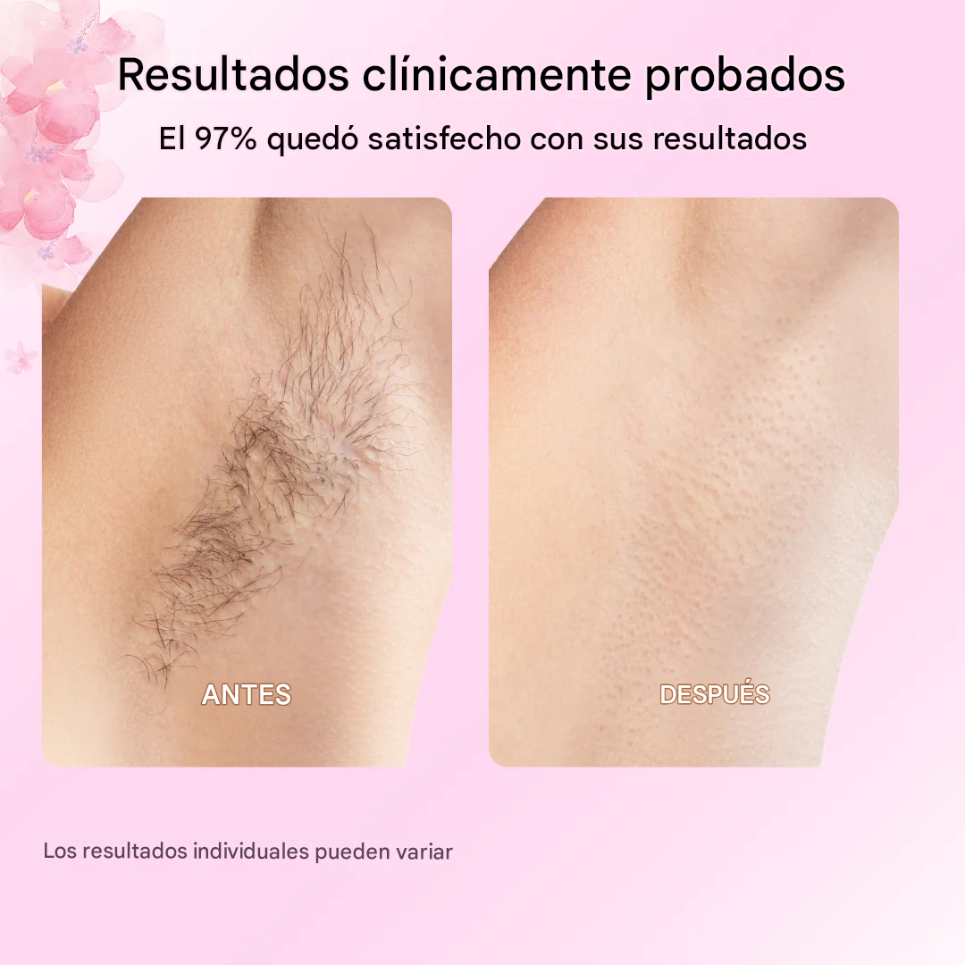 OFERTA ESPECIAL LLEVA DOS ACEITES DE CYPERUS ROTUNDUS