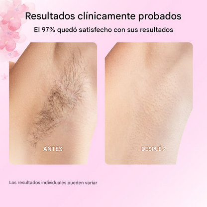 OFERTA ESPECIAL LLEVA DOS ACEITES DE CYPERUS ROTUNDUS