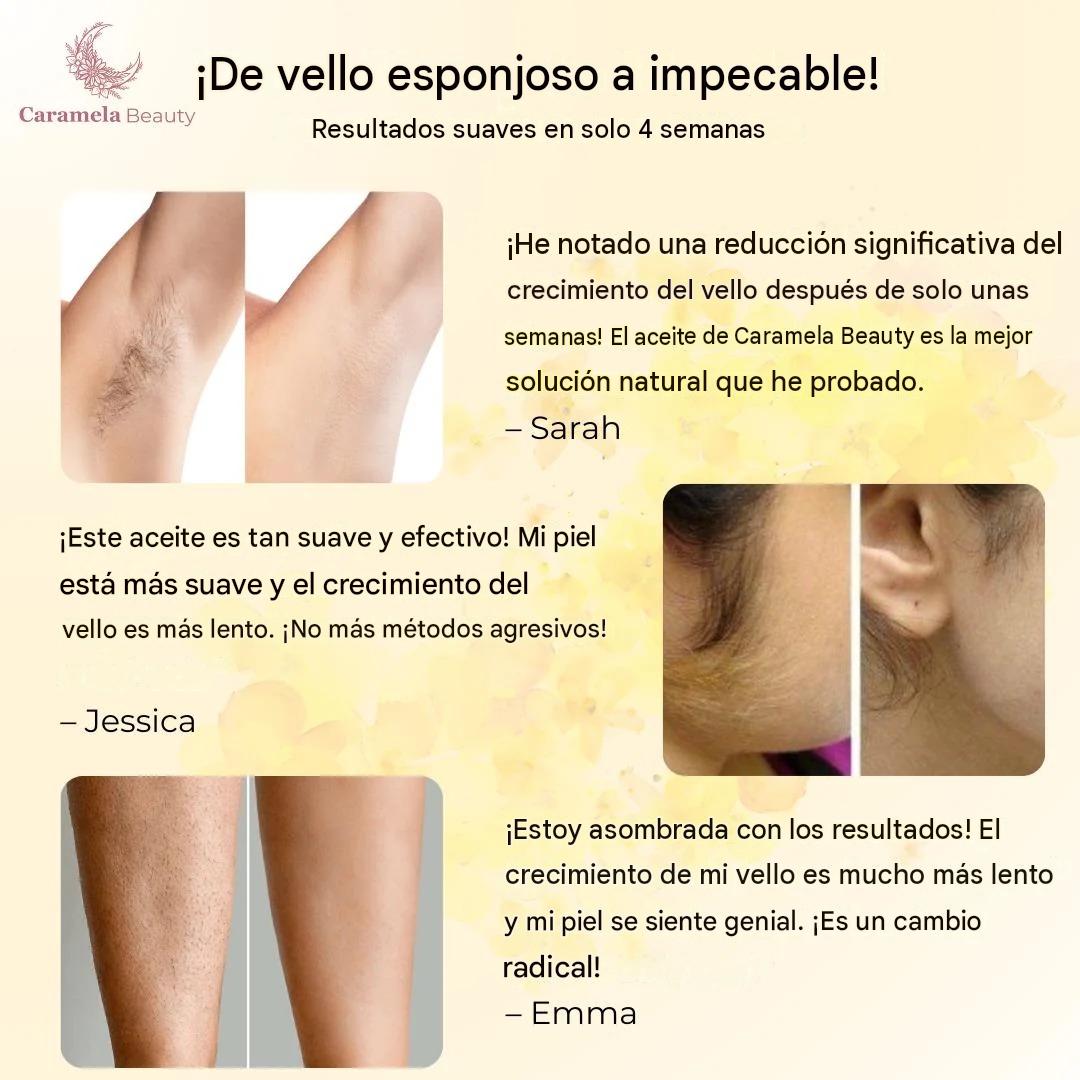 OFERTA ESPECIAL LLEVA DOS ACEITES DE CYPERUS ROTUNDUS
