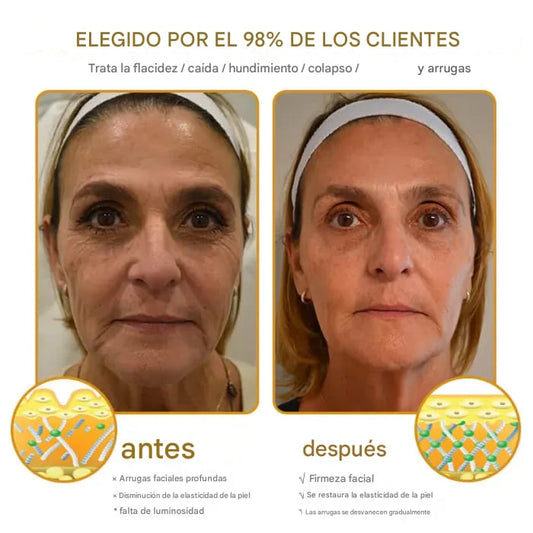 🌿Luce una piel visiblemente mas joven en pocos días - con el poder natural de Terra Lotus Honey Balm